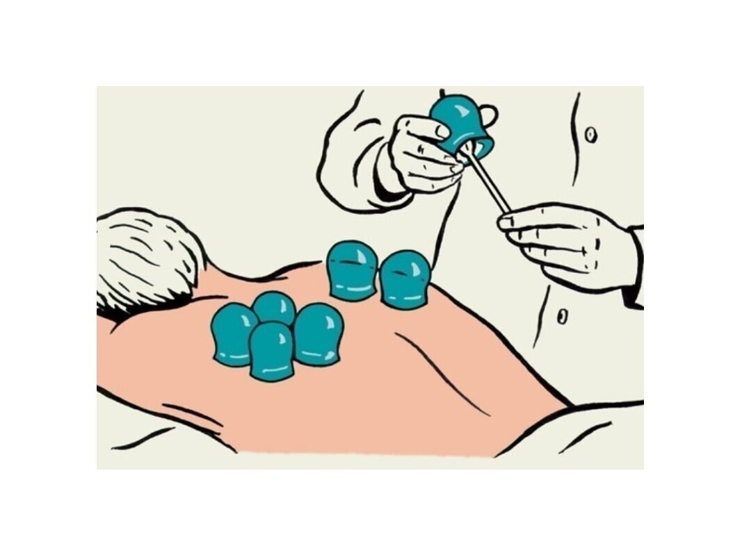 Vakuuminės medicininės stiklo taurės N1 1